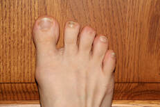 Toenails, Why do they Fall off for Runners? - Coach Boggs Running